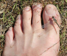 Dragonfly on my toe in Africa, Roger J. Wendell 04-20-2012