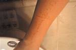 Mount Vernon, Ohio student's arm branded with a cross - 2008
